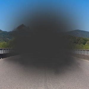 View of Macular Degeneration 