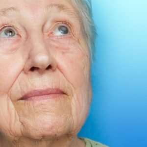 Woman with eye cataracts