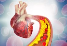 The New Heart Health Checklist graphic image of a heart_featured image for heart health article